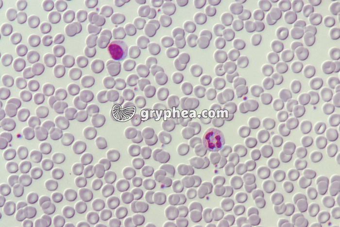 Frottis sanguin x100 - gryphea.com